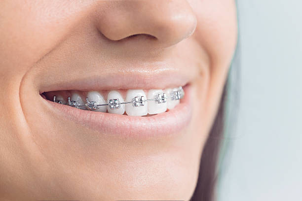 Best Veneers and Lumineers  in Cleveland Heights, OH